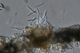 Septoria lycopersici image