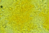 Lamprospora tuberculata image