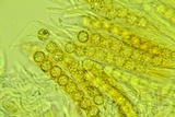 Lamprospora tuberculata image