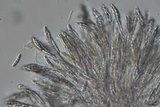 Bertia moriformis image