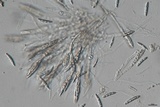 Bertia moriformis image