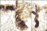 Buellia leptoclinoides image