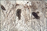 Buellia leptoclinoides image