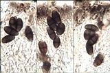 Buellia leptoclinoides image