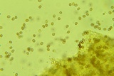 Cystoagaricus hirtosquamulosus image