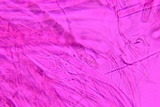 Sarcoscypha austriaca image