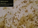 Diploicia canescens image