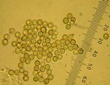 Lycoperdon echinatum image