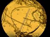 Lycoperdon echinatum image
