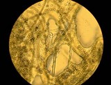 Lycoperdon echinatum image