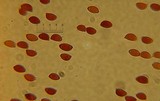 Leucoagaricus rubrotinctus image