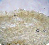 Galerina vittiformis image
