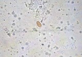 Galerina vittiformis image
