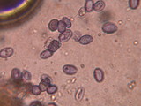 Melanoleuca subpulverulenta image