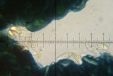 Lecania dubitans image