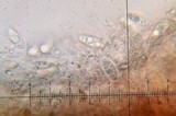 Lecidea berengeriana image