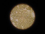 Disciseda candida image