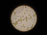 Disciseda candida image