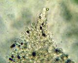 Agaricus bitorquis image