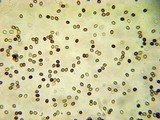 Agaricus bitorquis image