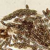 Phaeocalicium populneum image