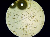 Agaricus bitorquis image