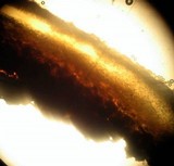 Scleroderma areolatum image