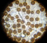 Scleroderma areolatum image