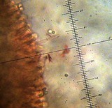 Melanoleuca exscissa var. exscissa image