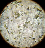 Disciseda brandegei image