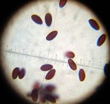 Psathyrella bipellis image