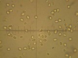 Abortiporus biennis image