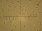 Abortiporus biennis image