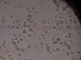 Lycoperdon dermoxanthum image