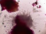 Hypomyces aurantius image