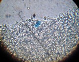 Leucoagaricus caerulescens image