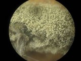 Botrytis cinerea image