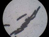 Sporormiella australis image