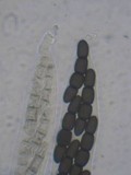 Sporormiella australis image