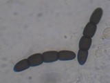 Sporormiella australis image