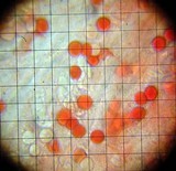 Hydnum oregonense image