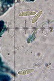 Biatora carneoalbida image