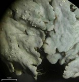 Heterodermia granulifera image