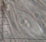 Lecidella enteroleucella image
