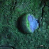 Pertusaria paratuberculifera image