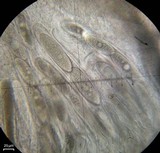 Pertusaria paratuberculifera image