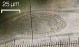 Pertusaria paratuberculifera image