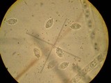 Sowerbyella rhenana image