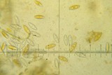 Byssonectria fusispora image