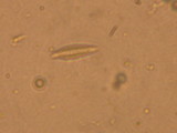 Hypomyces lateritius image